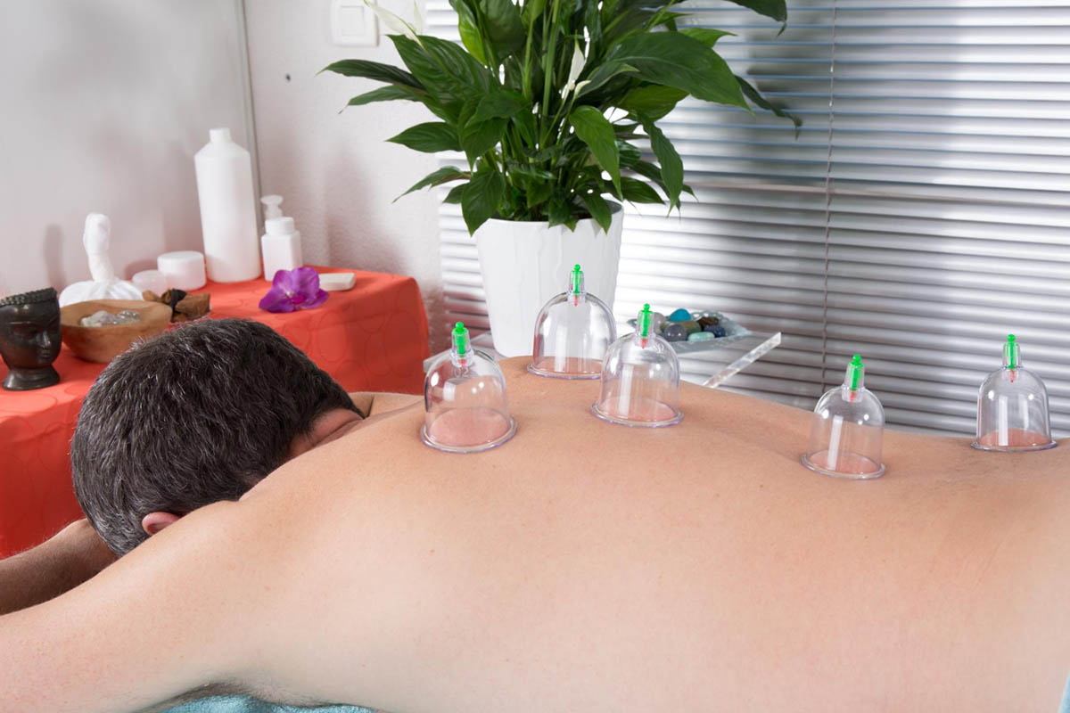 Effectiveness of Cupping Therapy for Back Pain